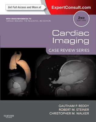 Cardiac Imaging: Case Review Series 