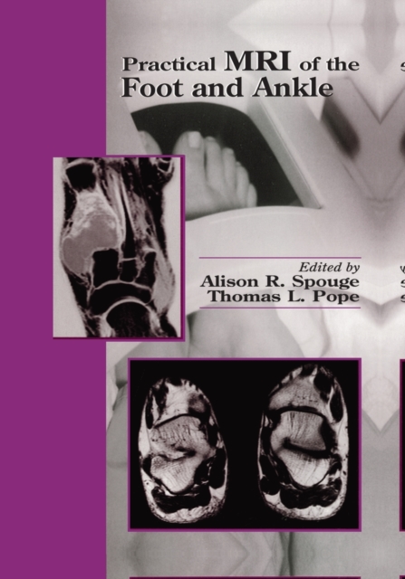 Practical MRI of the Foot and Ankle 