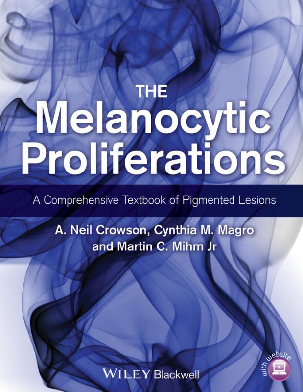 Melanocytic Proliferations A Comprehensive Textbook of Pigmented Lesions