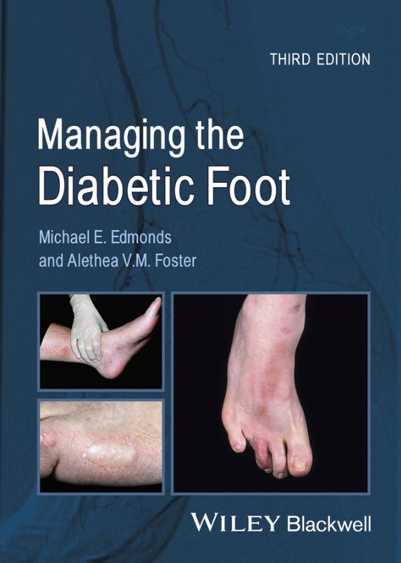 Managing the Diabetic Foot 