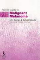 Pocket Guide to Malignant Melanoma 