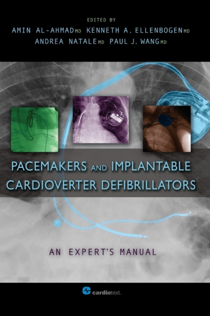 Pacemakers and Implantable Cardioverter Defibrillators An Expert's Manual