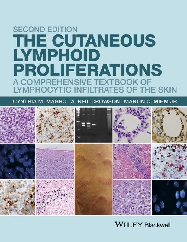 Cutaneous Lymphoid Proliferations A Comprehensive Textbook of Lymphocytic Infiltrates of the Skin