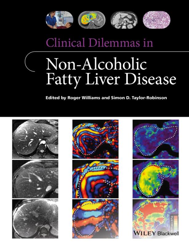 Clinical Dilemmas in Non-Alcoholic Fatty Liver Disease 