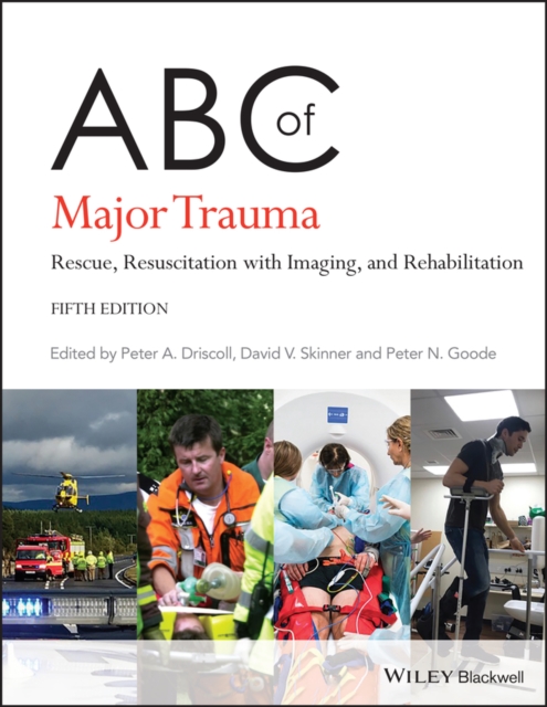 ABC of Major Trauma Rescue, Resuscitation with Imaging, and Rehabilitation