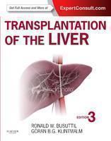 Transplantation of the Liver 