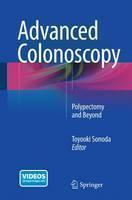 Advanced Colonoscopy Principles and Techniques Beyond Simple Polypectomy