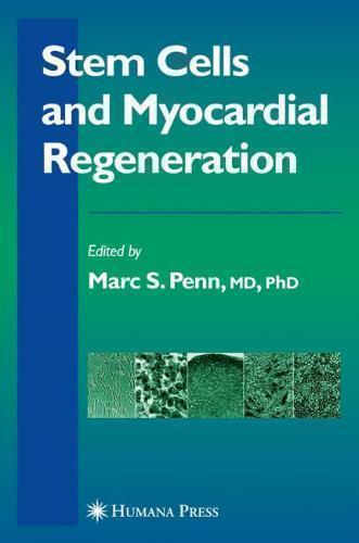 Stem Cells and Myocardial Regeneration 