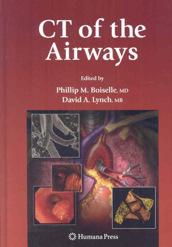 CT of the Airways 