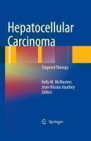 Hepatocellular Carcinoma: Targeted Therapy and Multidisc