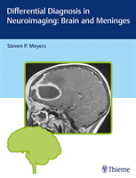 Differential Diagnosis in Neuroimaging: Brain and Meninges 