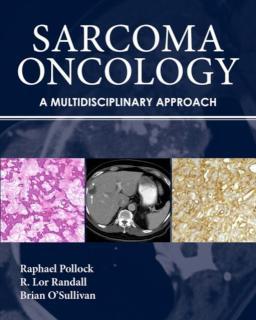 Sarcoma Oncology 