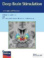 Deep Brain Stimulation Techniques and Practices