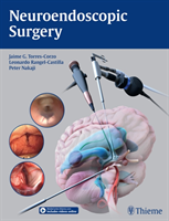 Neuroendoscopic Surgery 