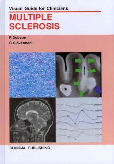 Multiple Sclerosis 
