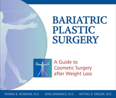 Bariatric Plastic Surgery A Guide to Cosmetic Surgery After Weight Loss