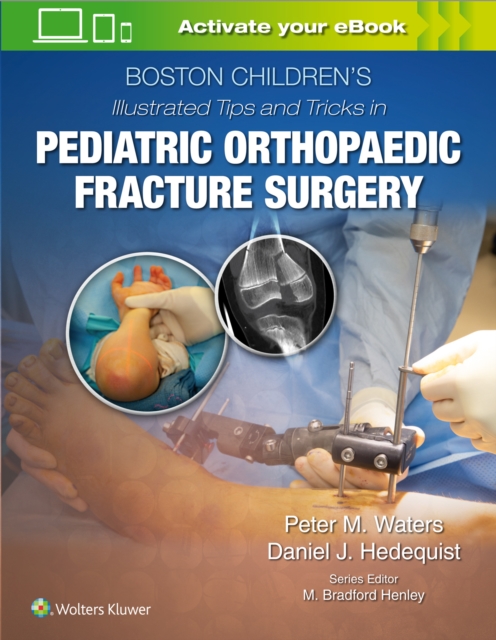 Boston Childrenâs Illustrated Tips and Tricks  in Pediatric Orthopaedic Fracture Surgery 