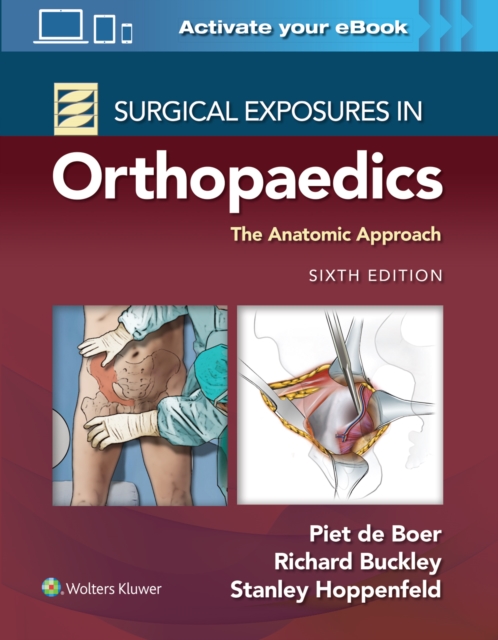 Surgical Exposures in Orthopaedics: The Anatomic Approach 