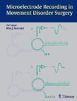 Microelectrode Recording in Movement Disorder Surgery
