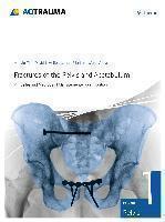 Fractures of the Pelvis and Acetabulum (AO) Principles and Methods of Mana