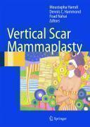 Vertical Scar Mammaplasty 