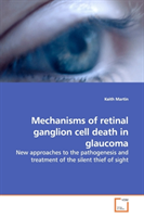 Mechanisms of retinal ganglion cell death in glaucoma 