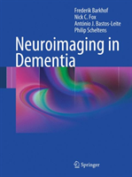 Neuroimaging in Dementia 