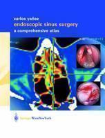 Endoscopic Sinus Surgery A Comprehensive Atlas