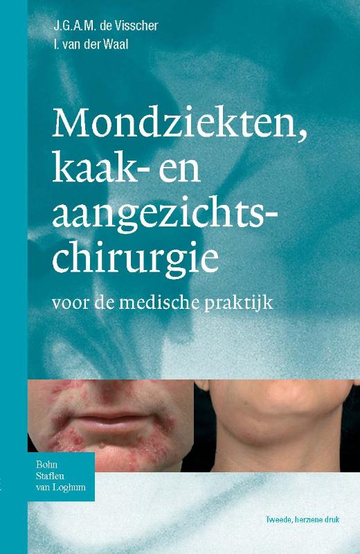 Zakboek mondziekten, kaak- en aangezichtchirurgie een leidraad voor de medische praktijk