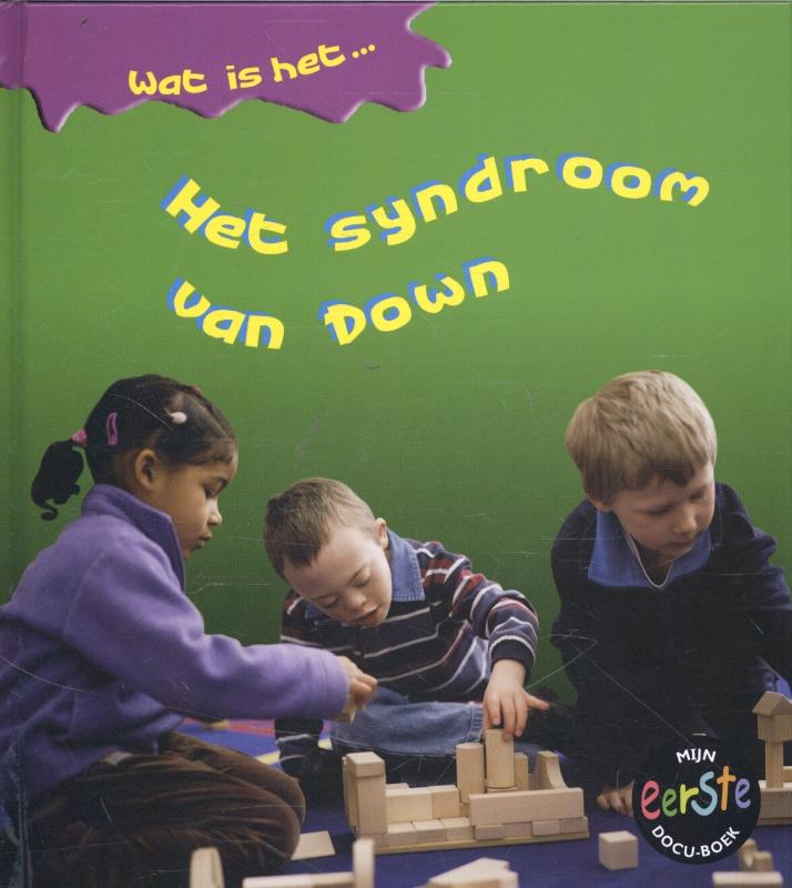 Het syndroom van Down 