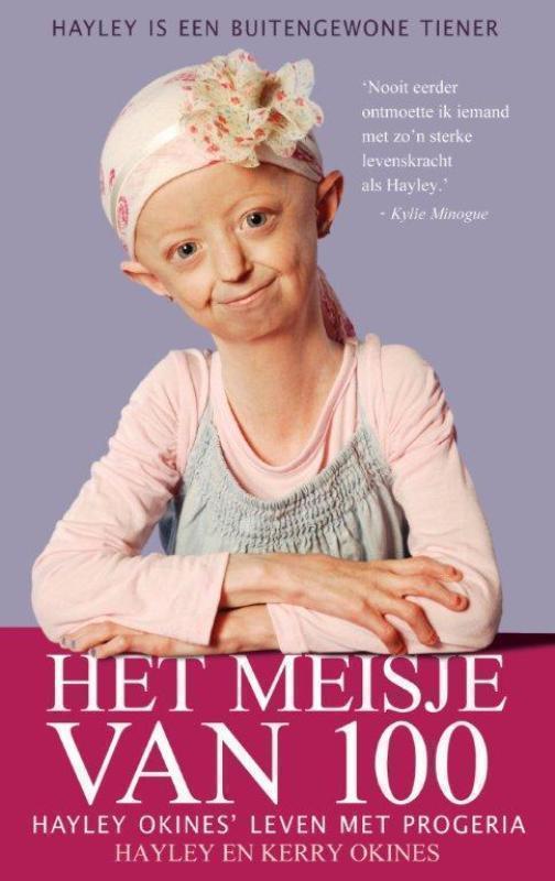 Het meisje van 100 ' leven met progeria