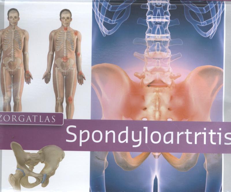 Zorgatlas Spondyloartritis